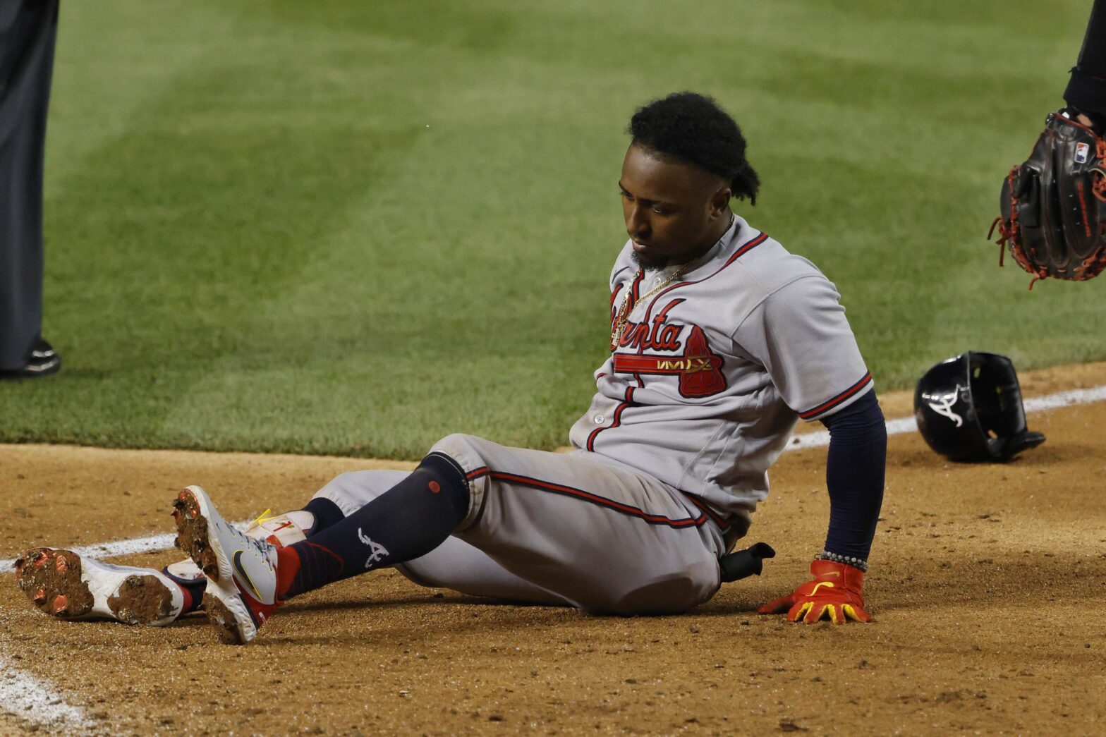Ozzie Albies Has Surgery On Fractured Foot